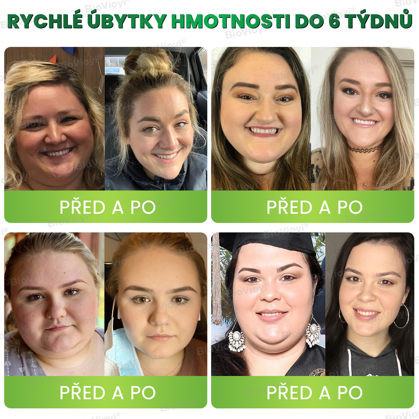 🍏BioVioyi® GLP-1 Metabolický Boost 🏆(Potravinářský spalovač tuku – vyvinutý Společností pro výzkum obezity)