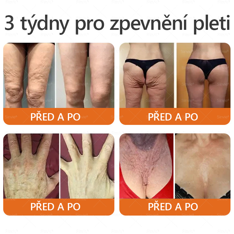 🐝🐝 Sinvie® Krém na obnovu pleti s včelím jedem 👨⚕ Doporučeno dermatology ✅CE schváleno - 50ml