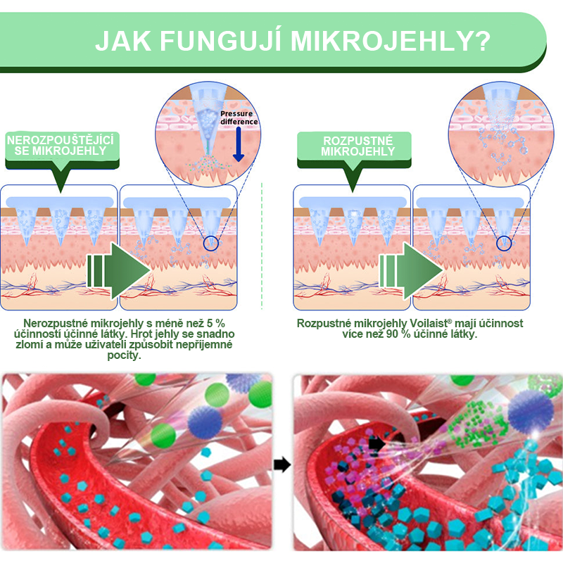 🥑Voilaist® SMGT-GLP-1 Nano Microneedlová Náplast ⏰ (Bezbolestná, dlouhotrvající, zaměřená na řešení cukrovky, obezity a kardiovaskulárních onemocnění)