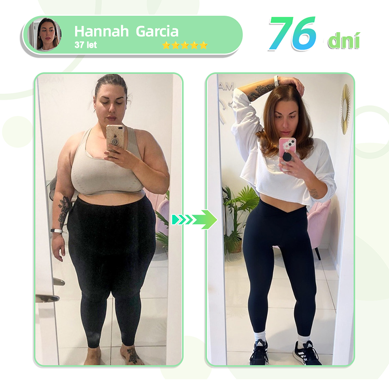 🥑Voilaist® SMGT-GLP-1 Nano Microneedlová Náplast ⏰ (Bezbolestná, dlouhotrvající, zaměřená na řešení cukrovky, obezity a kardiovaskulárních onemocnění)