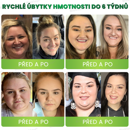 🍏BioVioyi® GLP-1 Metabolický Boost 🏆（Potravinářský spalovač tuku – vyvinutý Společností pro výzkum obezity）