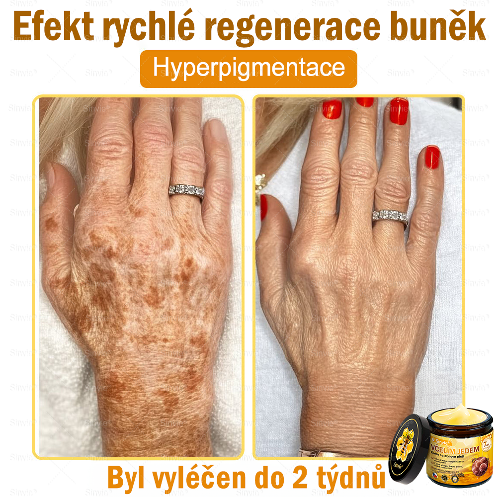 🌻 Sinvie® Krém na obnovu pleti s včelím jedem 🔥 Doporučeno dermatology | Proti vráskám, pigmentovým skvrnám a ochablé pleti - 50 ml