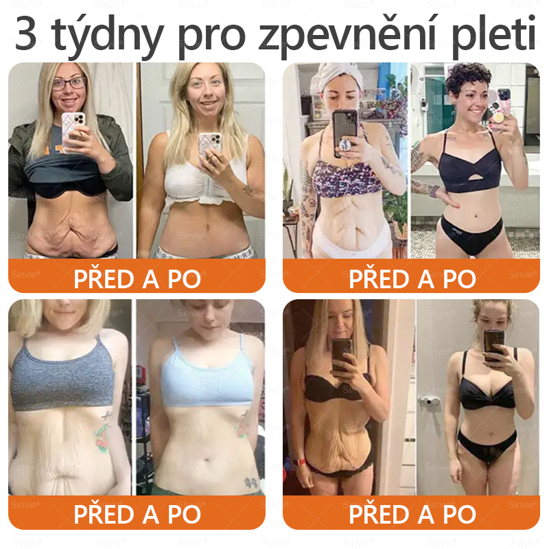 🐝🐝 Sinvie® Krém na obnovu pleti s včelím jedem 👨‍⚕ Doporučeno dermatology ✅CE schváleno - 50ml
