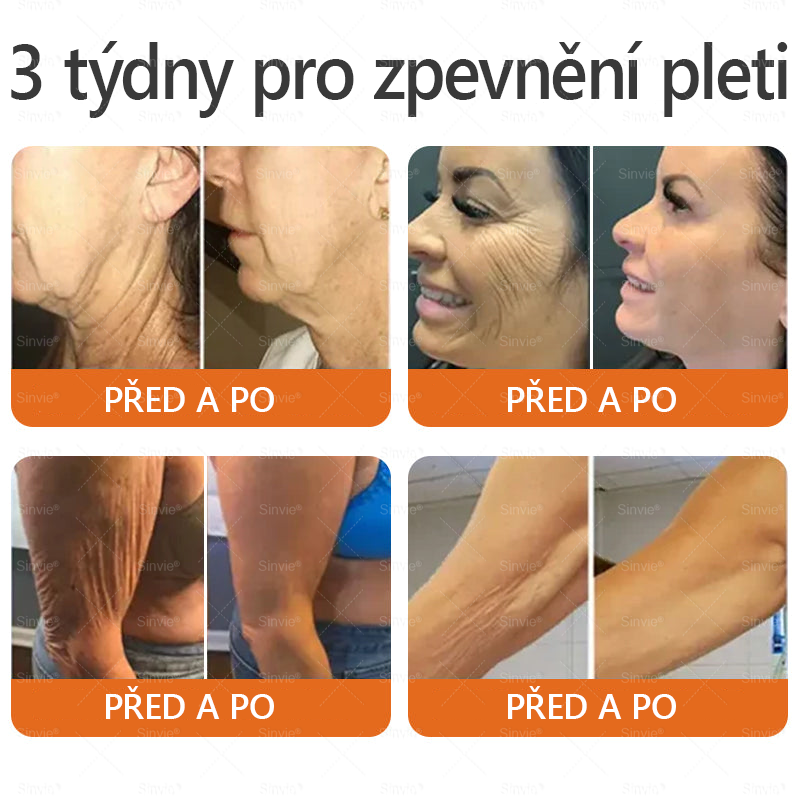 🐝🐝 Sinvie® Krém na obnovu pleti s včelím jedem 👨‍⚕ Doporučeno dermatology ✅CE schváleno - 50ml