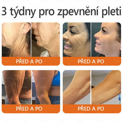 🐝🐝 Sinvie® Krém na obnovu pleti s včelím jedem 👨‍⚕ Doporučeno dermatology ✅CE schváleno - 50ml