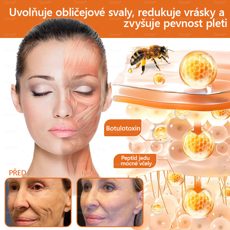 🐝🐝 Sinvie® Krém na obnovu pleti s včelím jedem 👨‍⚕ Doporučeno dermatology ✅CE schváleno - 50ml