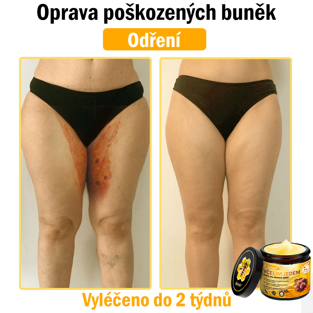 🐝🐝 Sinvie® Krém na obnovu pleti s včelím jedem 👨‍⚕ Doporučeno dermatology ✅CE schváleno - 50ml