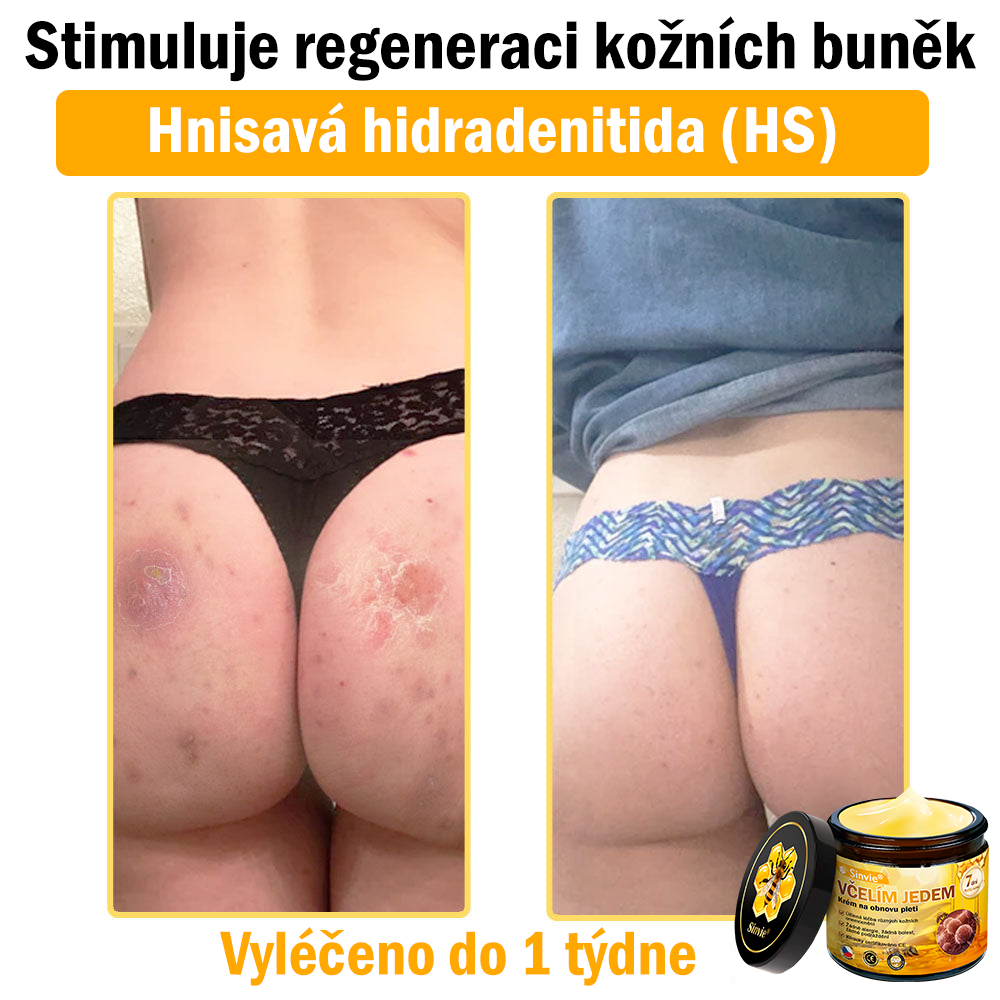 🐝🐝 Sinvie® Krém na obnovu pleti s včelím jedem 👨‍⚕ Doporučeno dermatology ✅CE schváleno - 50ml