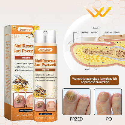 【Doporučeno odborníky】💛💛Zenvira® NailRescue Přírodní Sprej — ✅ Prokázaná účinnost proti lámavosti a žloutnutí nehtů během 7 dní!