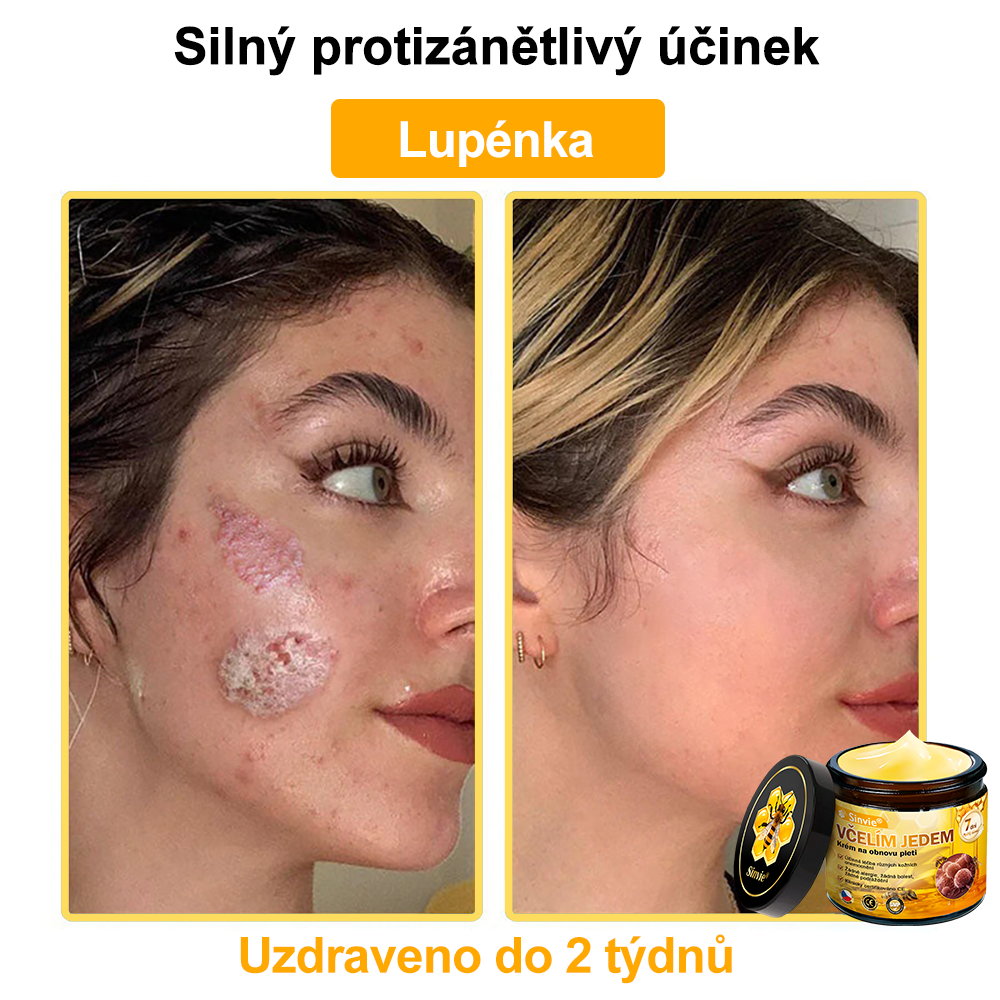 🐝🐝 Sinvie® Krém na obnovu pleti s včelím jedem 👨‍⚕ Doporučeno dermatology ✅CE schváleno - 50ml