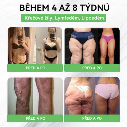 👩‍⚕️Klinicky ověřeno | CrazyLeaf® SMGT-GLP-1 Slim & Vitality – orální roztok proti přebytečné váze, tlaku, cukru, tukové játre, bolestem kloubů, únavě, nízké energii a ochablé pokožce. Lepší zdraví, více energie!