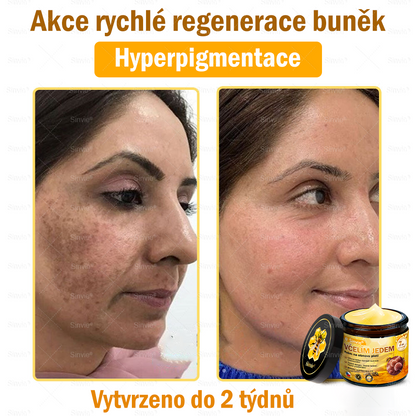 🐝🐝 Sinvie® Krém na obnovu pleti s včelím jedem 👨‍⚕ Doporučeno dermatology ✅CE schváleno - 50ml