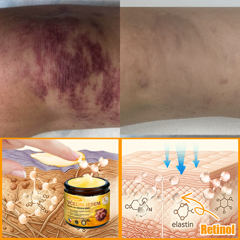 🐝🐝 Sinvie® Krém na obnovu pleti s včelím jedem 👨‍⚕ Doporučeno dermatology ✅CE schváleno - 50ml