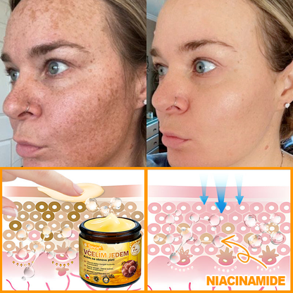 🐝🐝 Sinvie® Krém na obnovu pleti s včelím jedem 👨‍⚕ Doporučeno dermatology ✅CE schváleno - 50ml