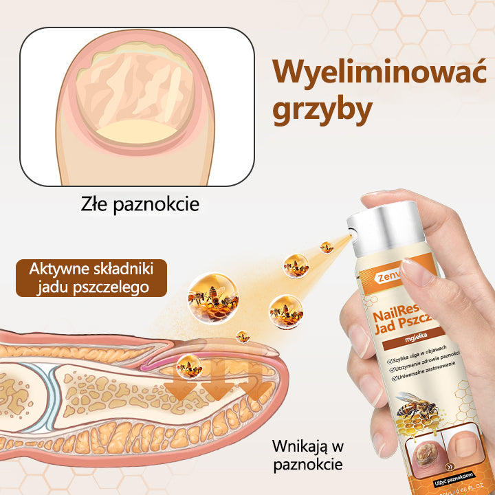【Doporučeno odborníky】💛💛Zenvira® NailRescue Přírodní Sprej — ✅ Prokázaná účinnost proti lámavosti a žloutnutí nehtů během 7 dní!